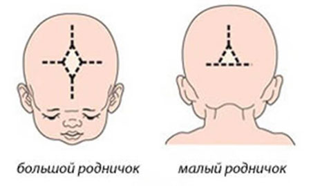 Каким должен быть родничок у новорожденного ребенка?